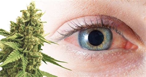 Cannabis und rote Augen: Was steckt dahinter? - Die Rolle von THC